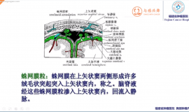 脑膜转移症状相关——学习笔记