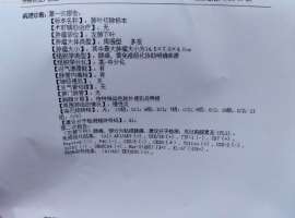 肺腺癌术后Her2扩增要不要加免疫？