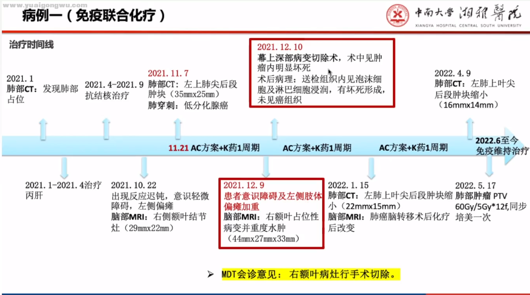 都说免疫不入脑，入了就不得了