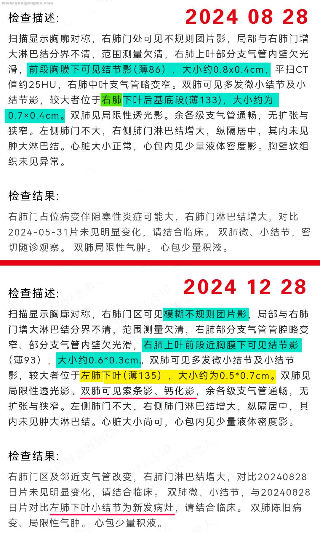 2024.8.28与2024.12.28检查对比